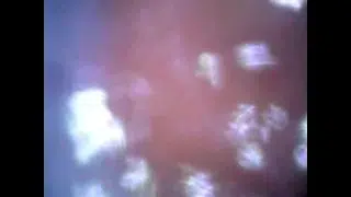 Deep look inside cum filled ass with endoscope