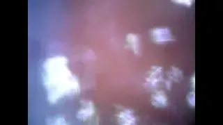 Deep look inside cum filled ass with endoscope